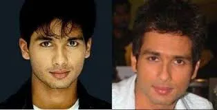 Bollywood Male Actors Plastic Surgery Before And After 2 C:\Users\Elcot\Downloads\2.jpg