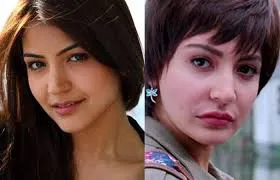 Bollywood Female Celebrities Plastic Surgery Before and After 3 C:\Users\Elcot\Downloads\3.jpg