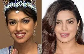 Bollywood Female Celebrities Plastic Surgery Before and After 8 C:\Users\Elcot\Downloads\4.jpg