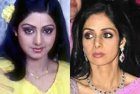 Bollywood Female Celebrities Plastic Surgery Before and After 9 C:\Users\Elcot\Downloads\5.jpg