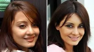 Bollywood Female Celebrities Plastic Surgery Before and After 4 C:\Users\Elcot\Downloads\7.jpg
