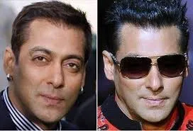 Bollywood Male Actors Plastic Surgery Before And After 6 C:\Users\Elcot\Downloads\8.jpg