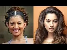 Bollywood Female Celebrities Plastic Surgery Before and After 5 C:\Users\Elcot\Downloads\8.jpg