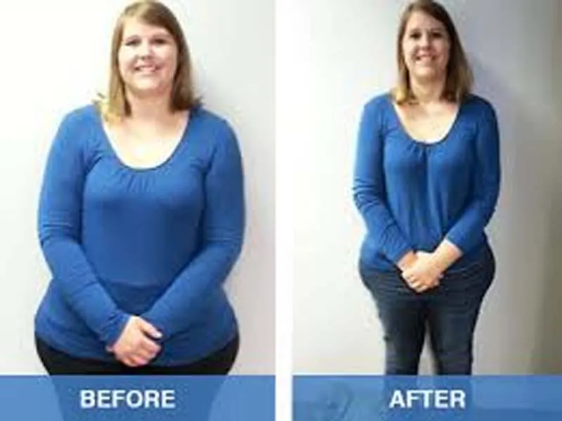 Anti-Obesity Day- Health Changing Scenario in 2018 2 Anti-Obesity Day- Health Changing Scenario in 2018 2