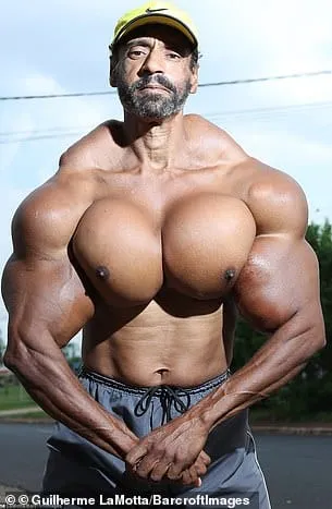 Brazilian Bodybuilder Risked life by Injecting Oil 4 BREAKING : Brazilian Bodybuilder Risked life by injecting oil
