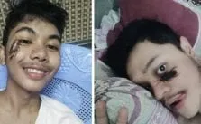 VIRAL : Cockroach Trend is Alarming