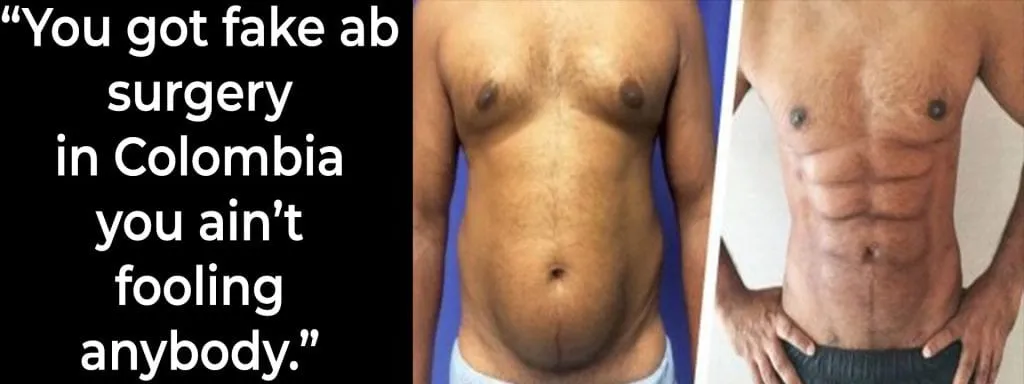 OMG : This Celeb shows off his surgical six pack surgery abs