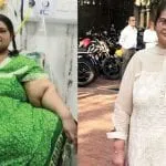 weight loss surgeries