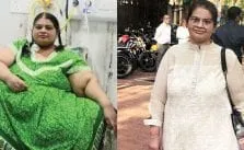 weight loss surgeries