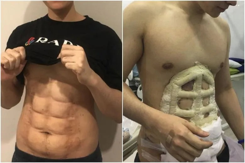 STOP EVERYTHING : Instant Six Pack Abs is a real thing Now [At Your Favorite Destination]