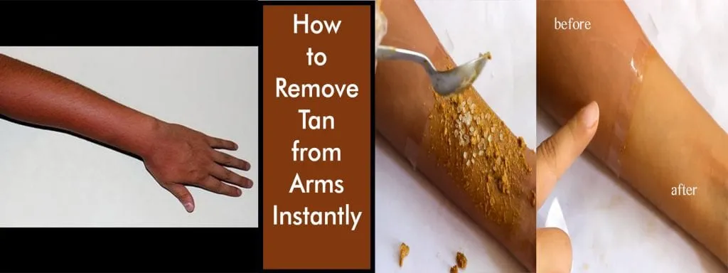 Homemade DIY – How To Remove Tan From Arms
