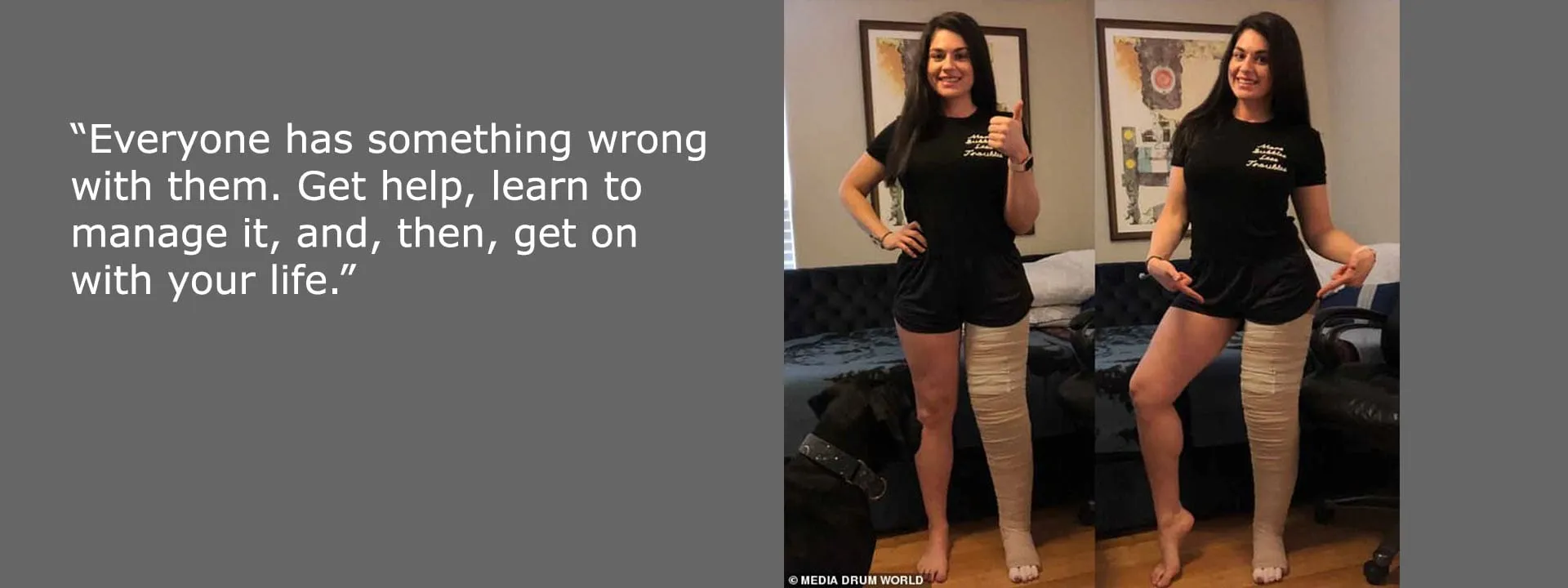 BREAKING : Women completed Triathlon with her Swollen Leg