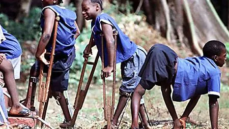 World Population Day 2019 Polio free World Population Day 2019 Polio free