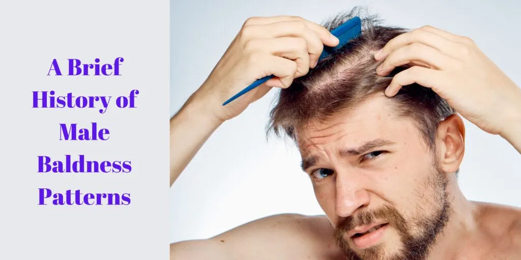 A Brief History of Male Baldness Patterns