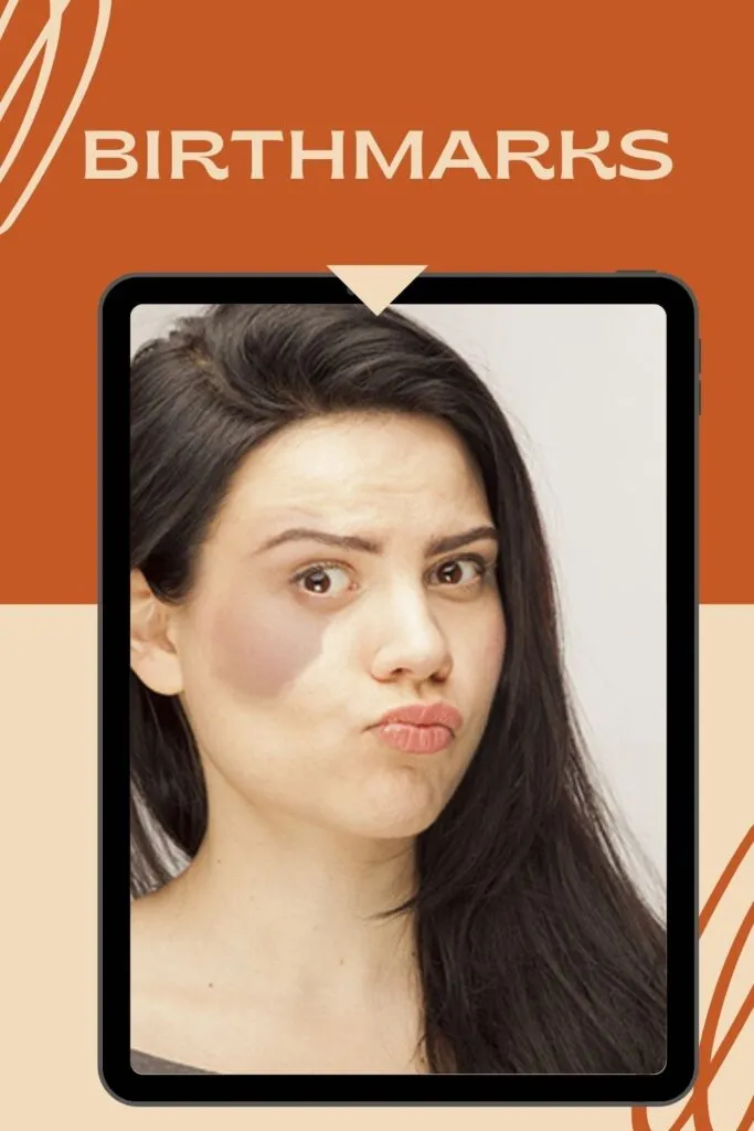 A girl is showing her birthmark under her eye A girl is showing her birthmark under her eye - skin care tips