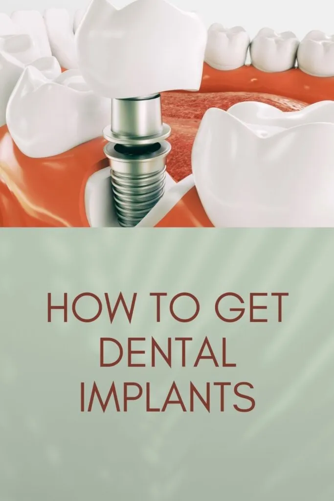 dental implant procedure dental implant procedure - dental implant
