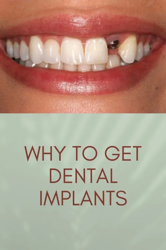 someone is smiling and showing missing tooth someone is smiling and showing missing tooth - dental implant