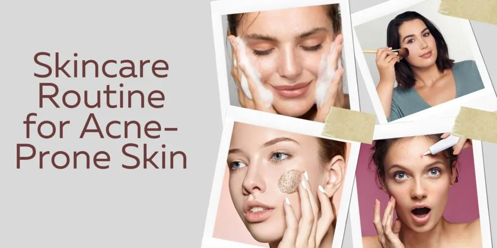 Identify and Create the Right Skincare Routine for Acne-Prone Skin