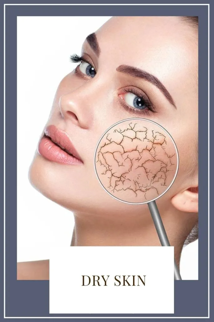 A girl is showing her dry skin A girl is showing her dry skin - daily skin care routine at home