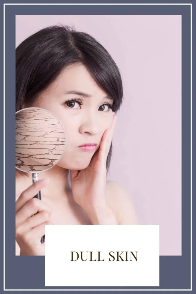 A girl is showing her dull skin A girl is showing her dull skin - lip care