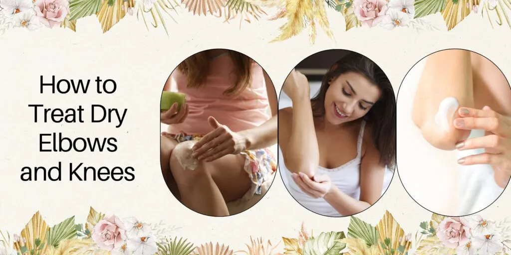 What Causes Dry Elbows and knees? How Can I Treat It?