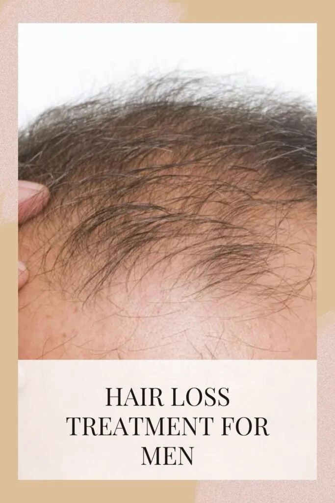 A man is showing his hair loss - Hair Loss Treatment