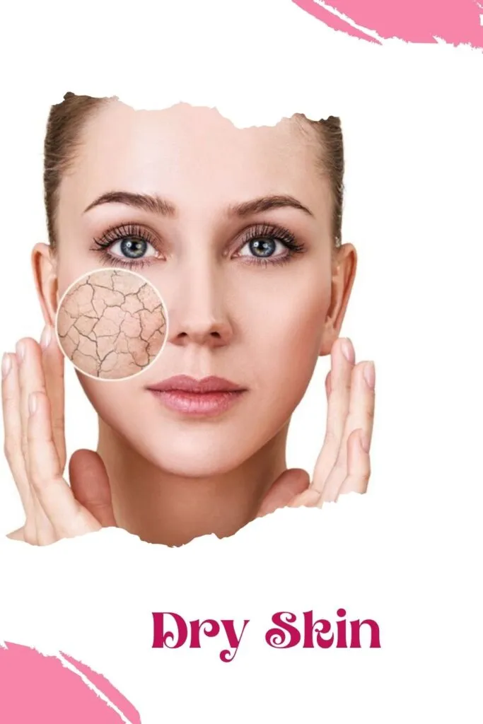 A girl is showing her dry skin A girl is showing her dry skin - skin care night routine
