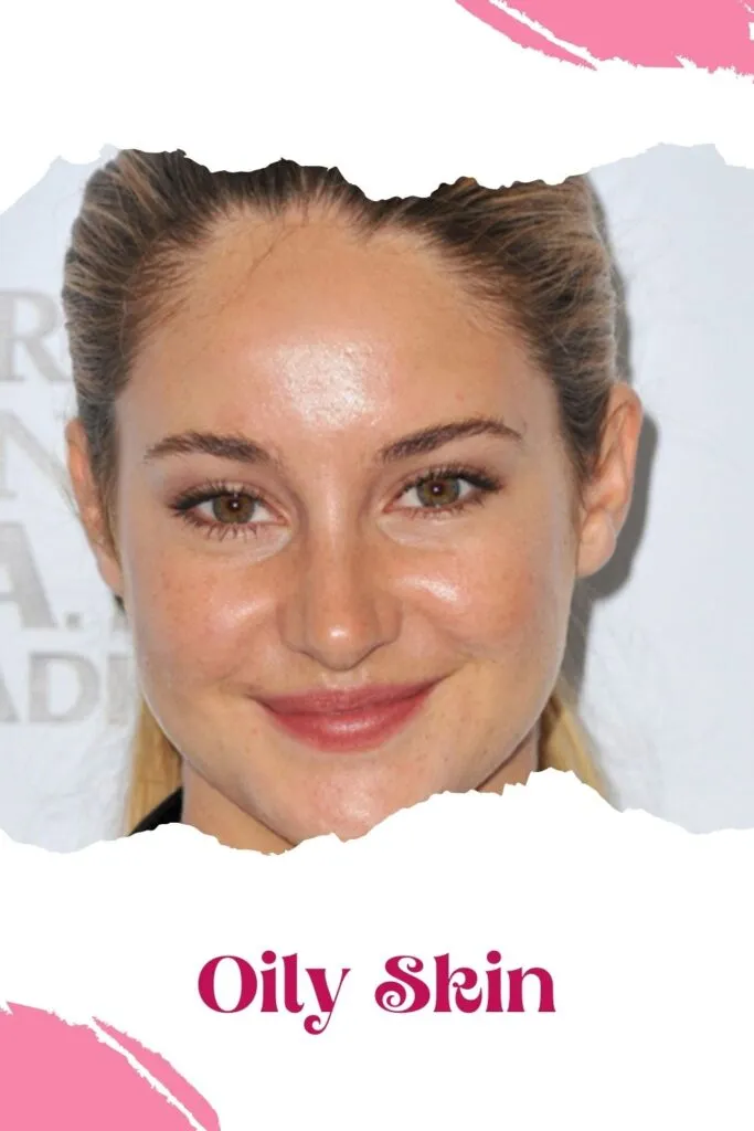 A smiling girl with oily skin A smiling girl with oily skin - skin care tips