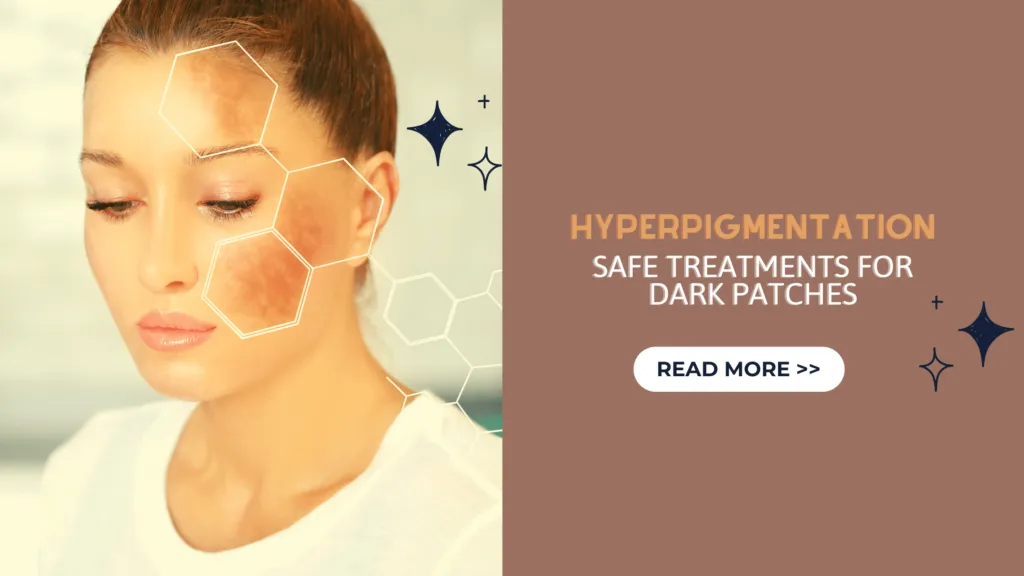 Hyperpigmentation: Safe Treatments for Dark Patches On the Skin