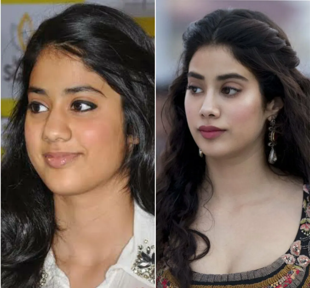 Jhanvi Kapoor before and after pics of cosmetic surgery Jhanvi Kapoor before and after pics of cosmetic surgery - hindi actress plastic surgery