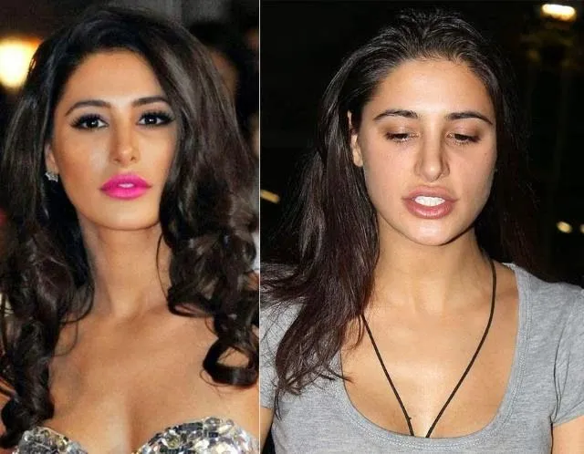 Nargis Fakhri before and after pics of cosmetic surgery Nargis Fakhri before and after pics of cosmetic surgery - surgery of bollywood actress