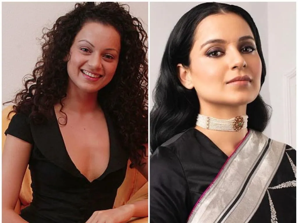 Kangana Ranaut before and after pics of cosmetic surgery Kangana Ranaut before and after pics of cosmetic surgery - cosmetic surgery actress