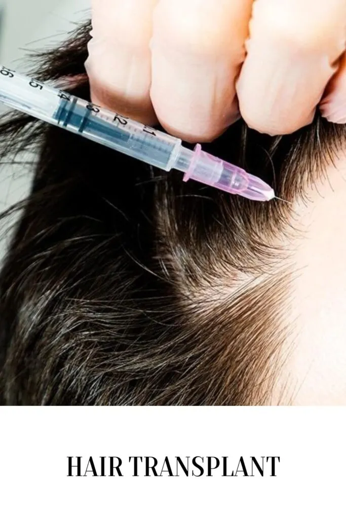 A doctor is giving an injection in head for hair transplant procedure A doctor is giving an injection in head for hair transplant procedure - hair transplant