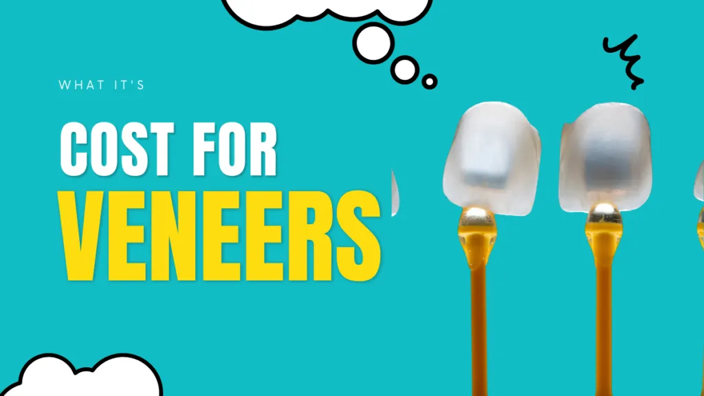Here’s What it Costs to Get Veneers in the US