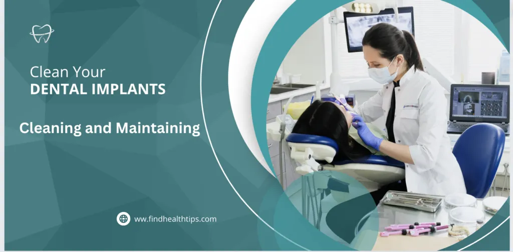 How to Clean All-on-4 Dental Implants