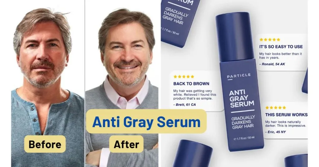 Time Machines Don’t Exist, But Particle Anti-Gray Serum Does.